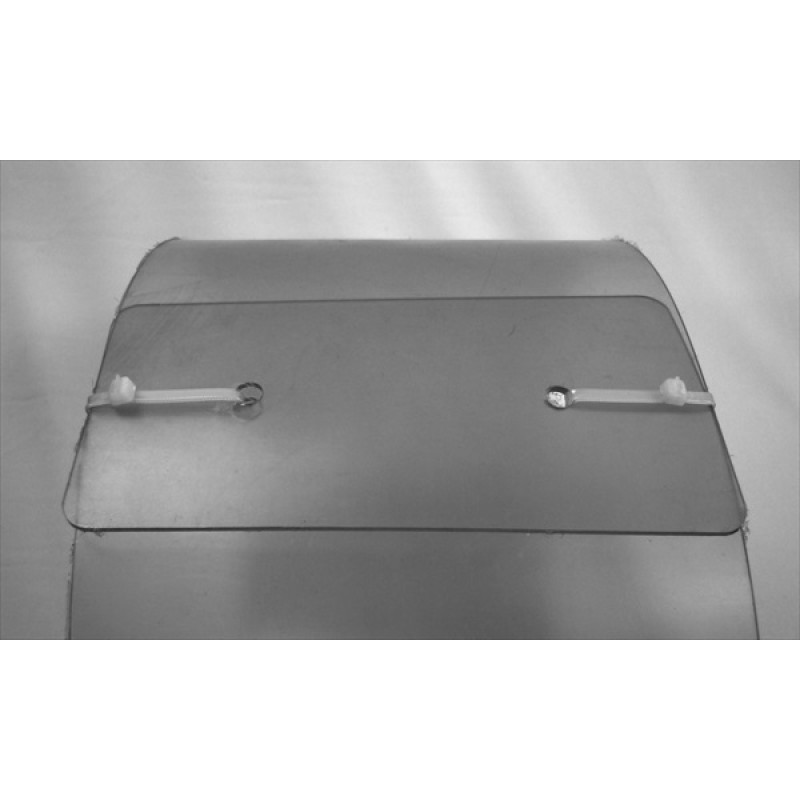 Repatriation Feature Protector